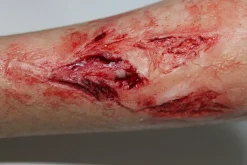 ForensicFX Studios Arm Lacerations/Cuts Prosthetic Shop