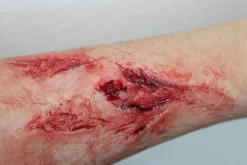 ForensicFX Studios Arm Lacerations/Cuts Prosthetic Shop