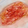 ForensicFX Studios Deep Fatty Tissue Wound Prosthetic Best