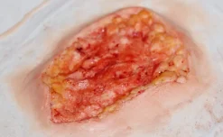ForensicFX Studios Deep Fatty Tissue Wound Prosthetic Best