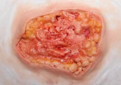 ForensicFX Studios Deep Fatty Tissue Wound Prosthetic Best