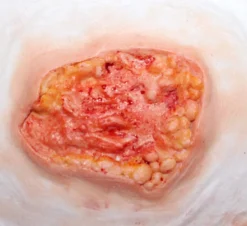 ForensicFX Studios Deep Fatty Tissue Wound Prosthetic Best