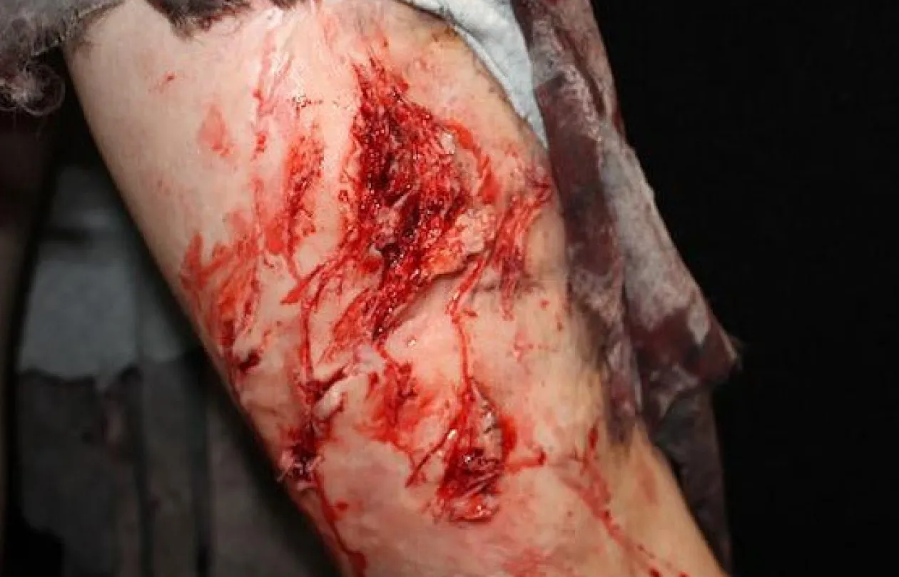 ForensicFX Studios Deep Leg Lacerations Prosthetic Online