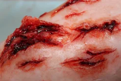 ForensicFX Studios Deep Leg Lacerations Prosthetic Online