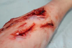 ForensicFX Studios Deep Leg Lacerations Prosthetic Online