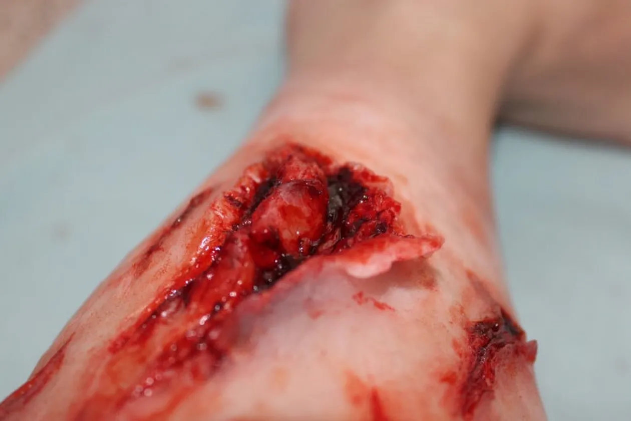 ForensicFX Studios Deep Leg Lacerations Prosthetic Online