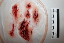 ForensicFX Studios Deep Leg Lacerations Prosthetic Online