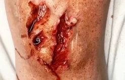 ForensicFX Studios Deep Opened Mangled Wounds Prosthetic Cheap