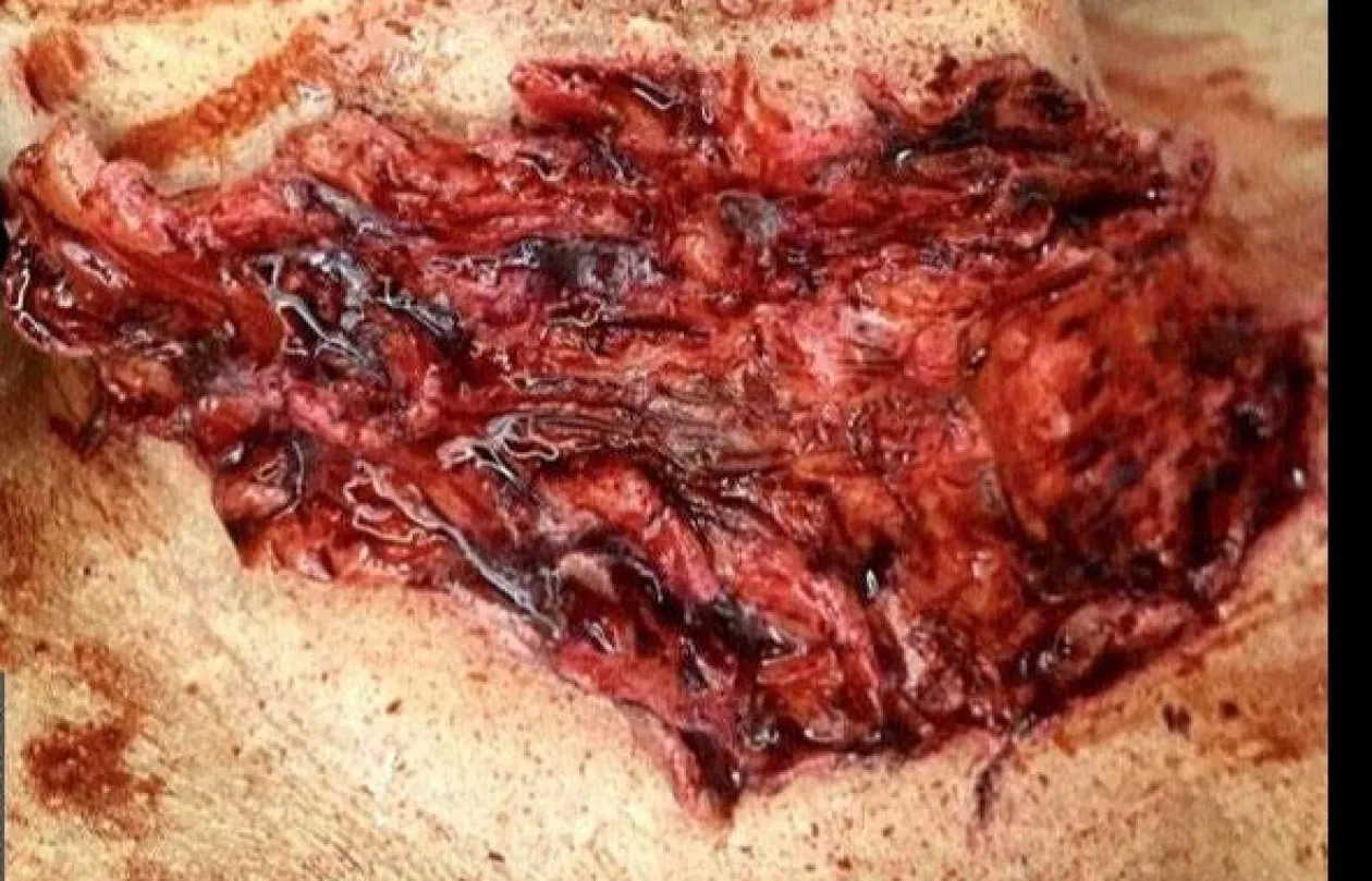 ForensicFX Studios Deep Slashed Trauma Wound Prosthetic Shop