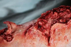 ForensicFX Studios Dog Bite Wound Prosthetic Outlet