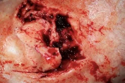 ForensicFX Studios Dog Bite Wound Prosthetic Outlet