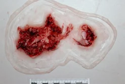 ForensicFX Studios Dog Bite Wound Prosthetic Outlet