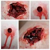 ForensicFX Studios Entry & Exit Bullet Wound Prosthetic Flash Sale