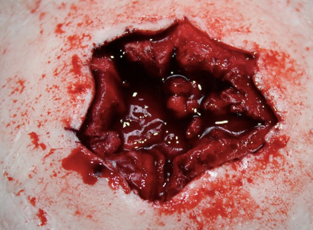 ForensicFX Studios Entry & Exit Bullet Wound Prosthetic Flash Sale