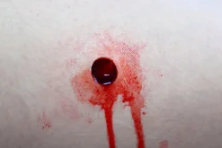 ForensicFX Studios Entry & Exit Bullet Wound Prosthetic Flash Sale