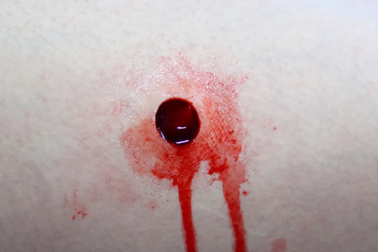ForensicFX Studios Entry & Exit Bullet Wound Prosthetic Flash Sale