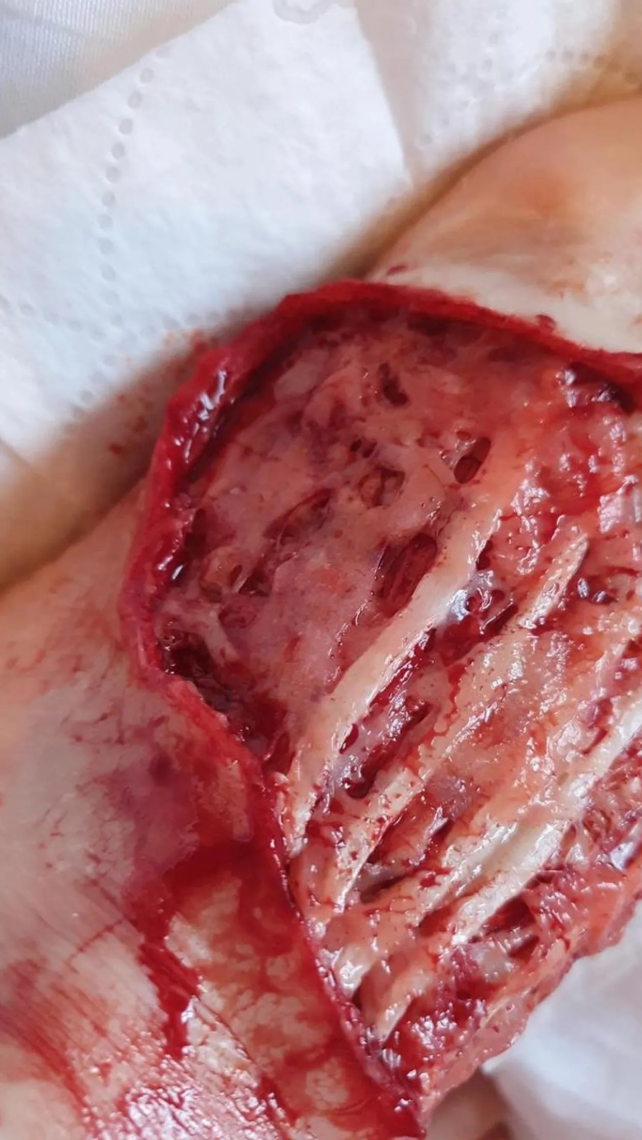 ForensicFX Studios Exposed Foot Ligaments Prosthetic Hot