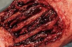 ForensicFX Studios Exposed Hand Ligaments Prosthetic Discount