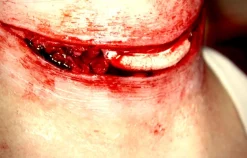 ForensicFX Studios Exposed Slit Throat Prosthetic Fashion