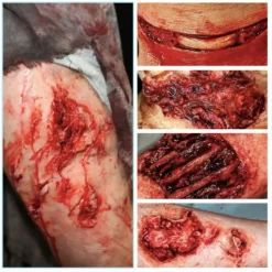 ForensicFX Studios Gorey Prosthetics Bundle Discount