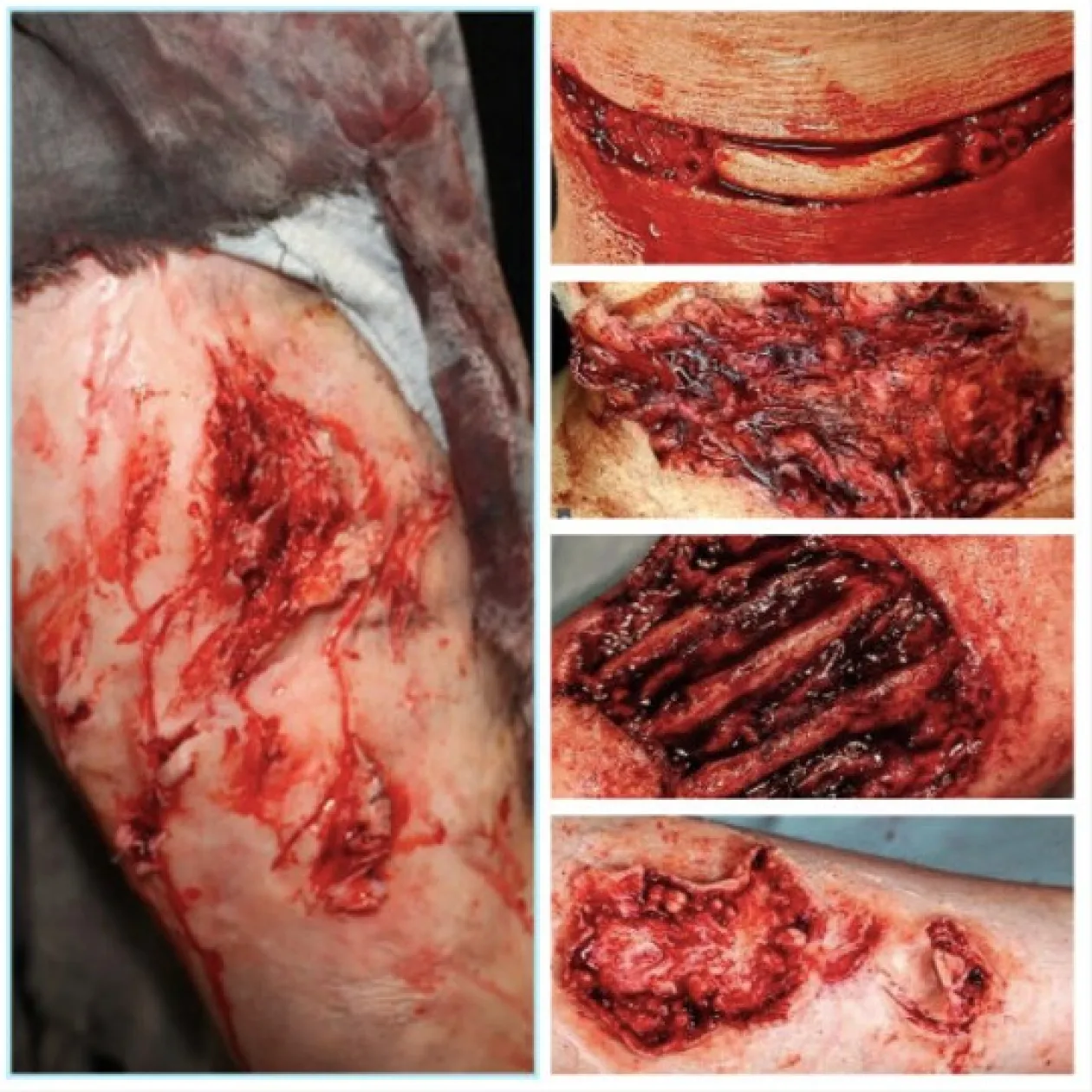 ForensicFX Studios Gorey Prosthetics Bundle Discount