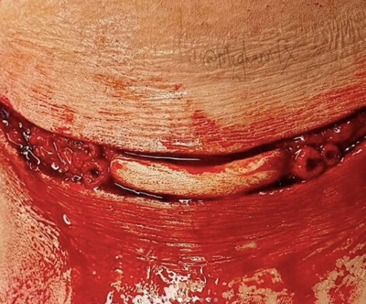 ForensicFX Studios Gorey Prosthetics Bundle Discount