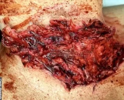 ForensicFX Studios Gorey Prosthetics Bundle Discount