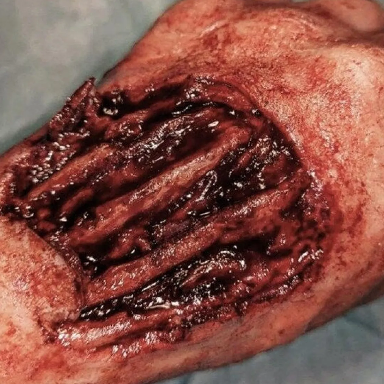 ForensicFX Studios Gorey Prosthetics Bundle Discount