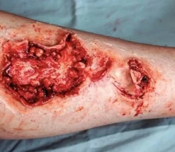 ForensicFX Studios Gorey Prosthetics Bundle Discount