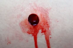 ForensicFX Studios Gunshot Entry Bullet Wound Prosthetic New