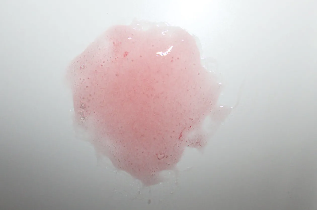 ForensicFX Studios Infected Medical Skin Graft Prosthetic Best Sale