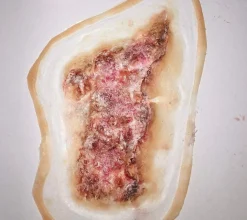 ForensicFX Studios Infected/Burn Wound Prosthetics Bundle Clearance