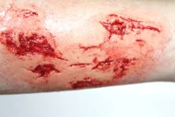 ForensicFX Studios Irregular Wound Lacerations Prosthetic Best Sale