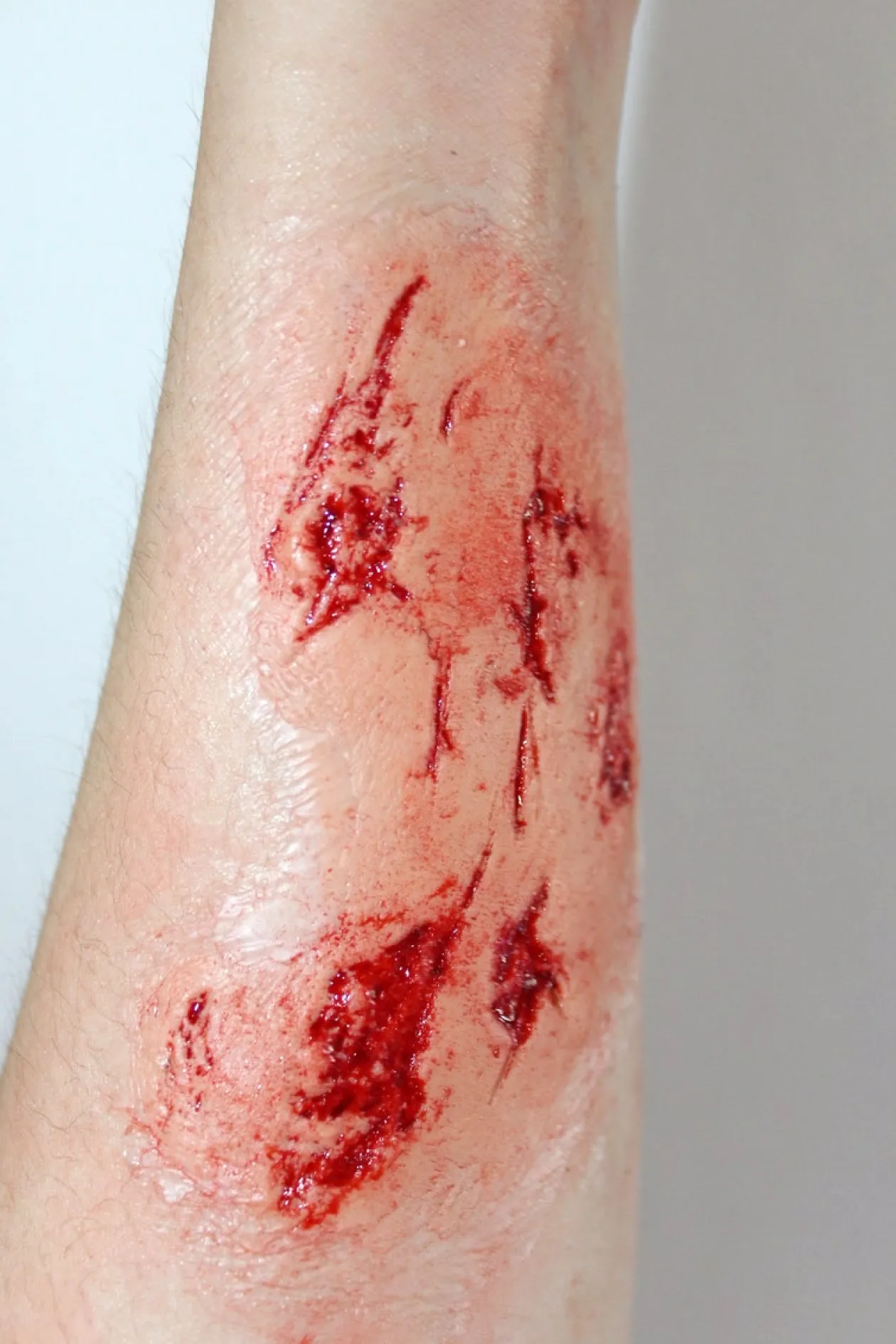 ForensicFX Studios Irregular Wound Lacerations Prosthetic Best Sale