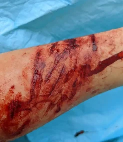 ForensicFX Studios Knife/Stab Wound Prosthetic Bundle Outlet