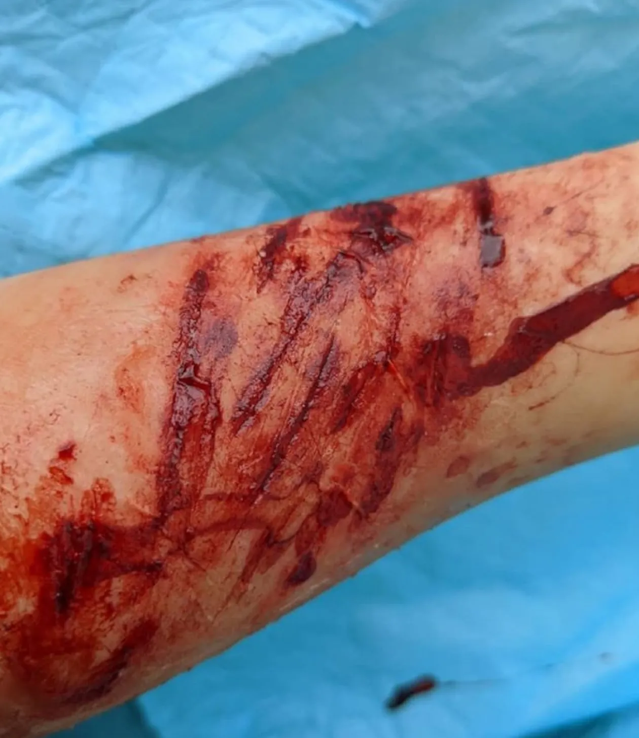 ForensicFX Studios Knife/Stab Wound Prosthetic Bundle Outlet