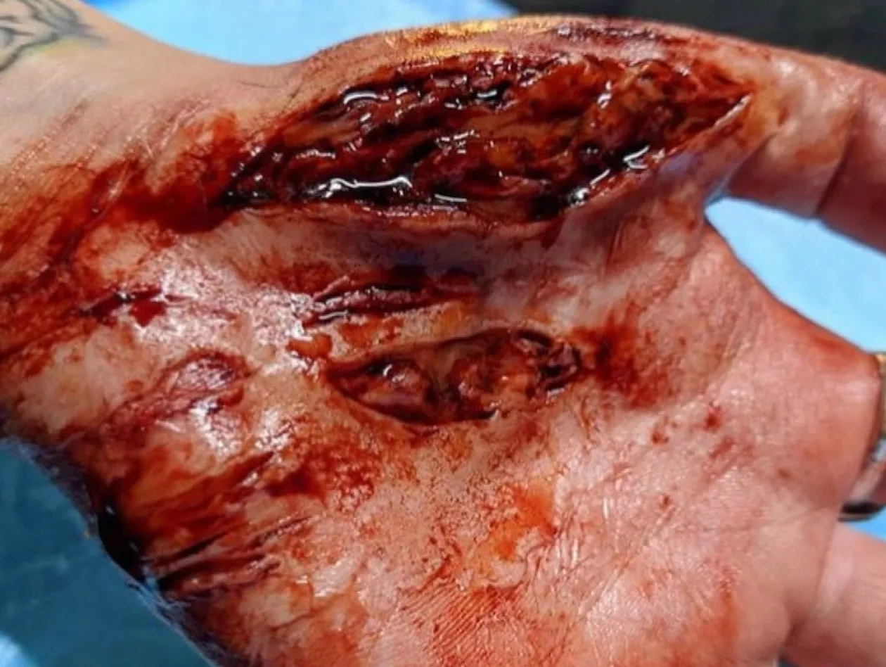 ForensicFX Studios Knife/Stab Wound Prosthetic Bundle Outlet