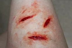 ForensicFX Studios Knife/Stab Wound Prosthetic Bundle Outlet