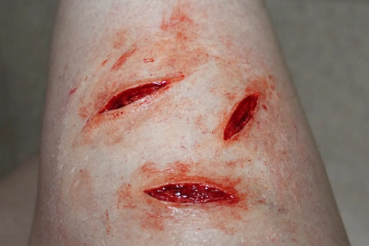 ForensicFX Studios Knife/Stab Wound Prosthetic Bundle Outlet