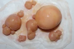 ForensicFX Studios Large Infected Boils Prosthetic Discount