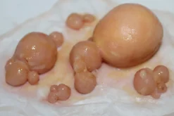 ForensicFX Studios Large Infected Boils Prosthetic Discount