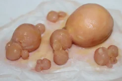 ForensicFX Studios Large Infected Boils Prosthetic Discount