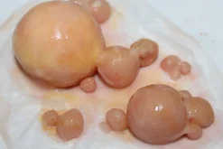 ForensicFX Studios Large Infected Boils Prosthetic Discount