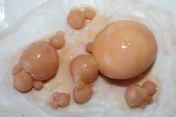 ForensicFX Studios Large Infected Boils Prosthetic Discount