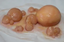 ForensicFX Studios Large Infected Boils Prosthetic Discount