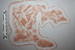 ForensicFX Studios Large Torso Skin Burn Prosthetic Fashion