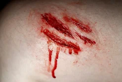 ForensicFX Studios Medium Scratch Mark Wounds Prosthetic Shop