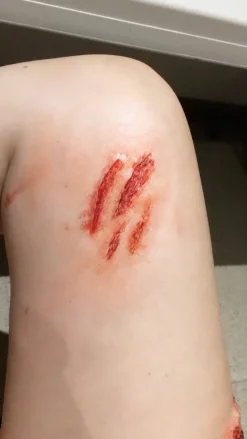 ForensicFX Studios Medium Scratch Mark Wounds Prosthetic Shop