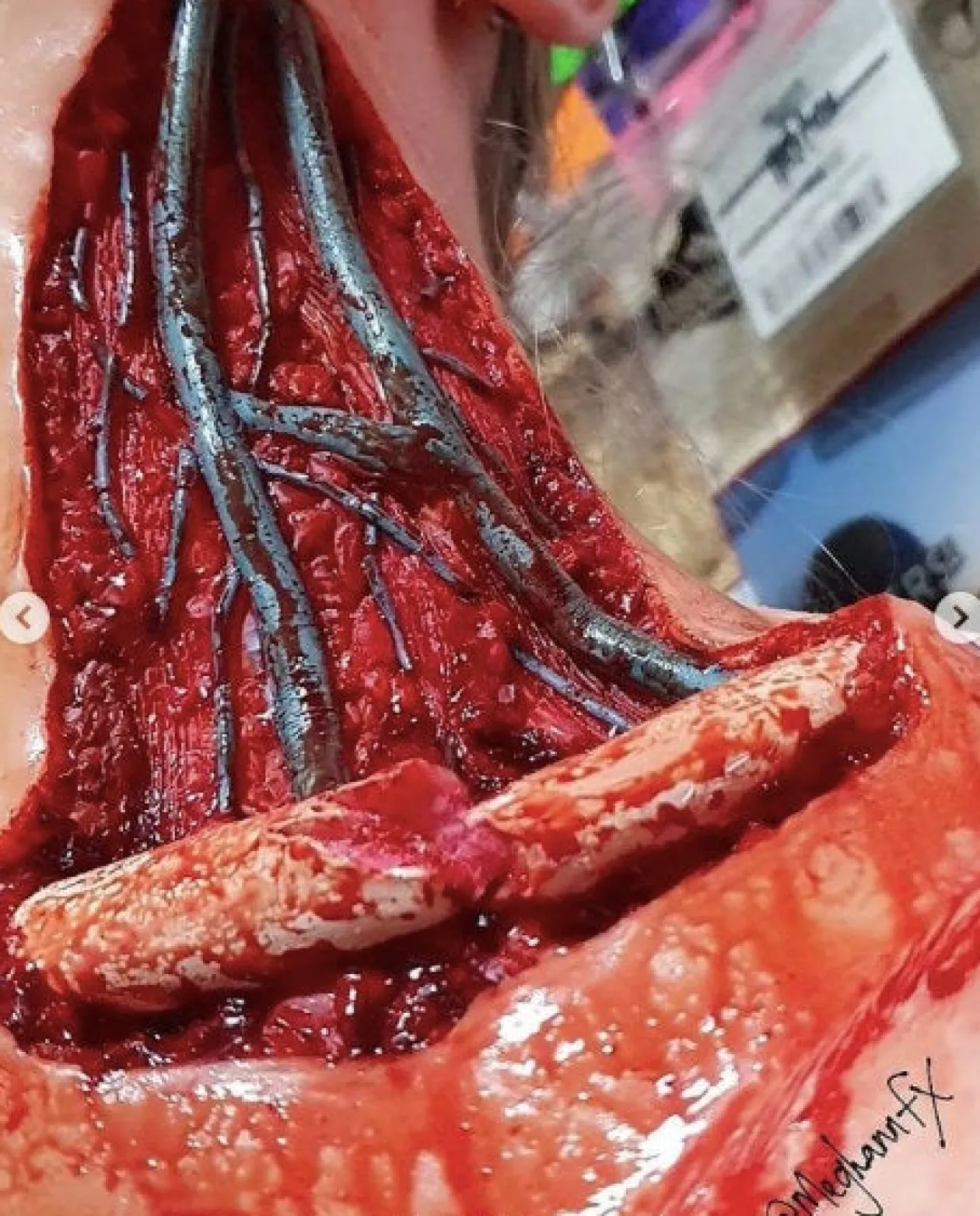 ForensicFX Studios Open Collarbone Wound Prosthetic Clearance