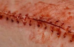 ForensicFX Studios Opened Stitches Prosthetic Store